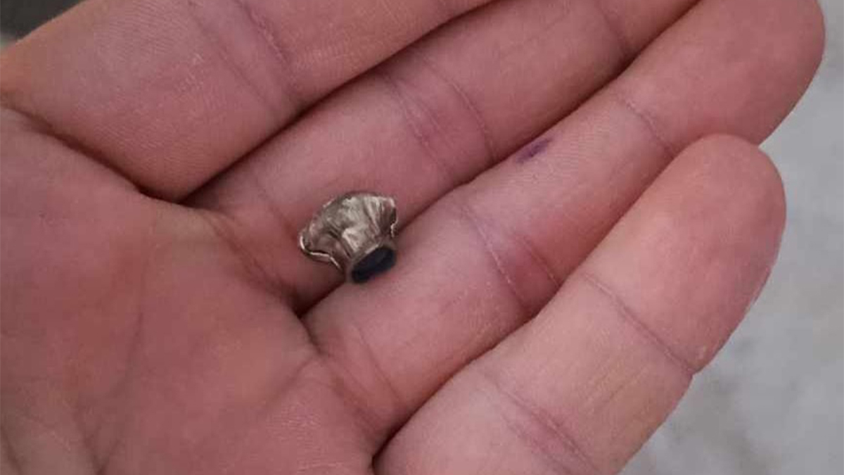 Şanlıurfa’da uyarılar, yasaklar boşa… Maganda kurşunu dama düştü